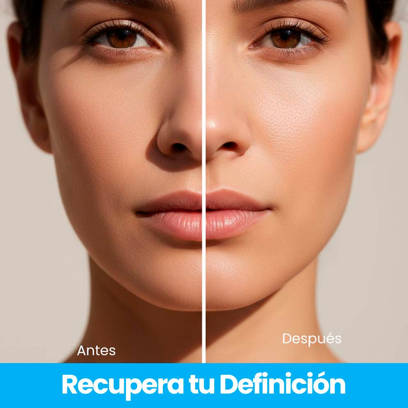 2. Cara más redonda en las fotos - tu mandíbula "desapareció"